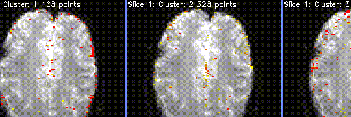 fMRI Analysis (from 1998)